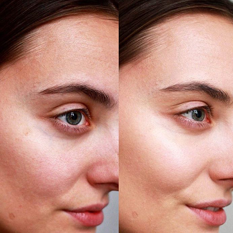 bb glow before and after